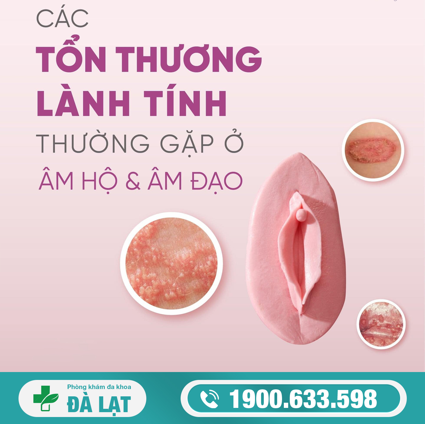 Hình ảnh minh họa